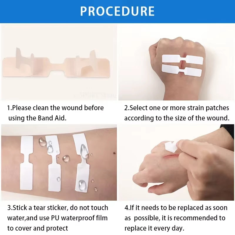 10Pcs Stitch-Free Band-Aids Painless Quick Wound Suture Zipper Adhesive Bandage Portable Outdoor Emergency Survival Accessories