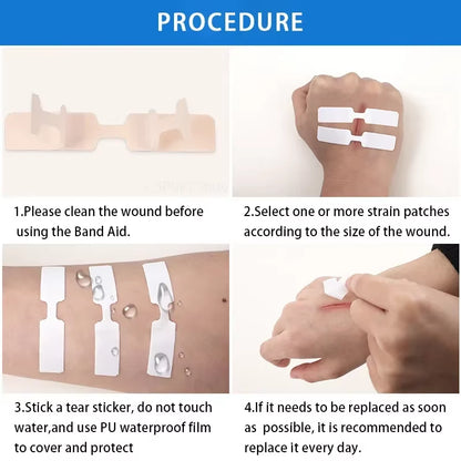 10Pcs Stitch-Free Band-Aids Painless Quick Wound Suture Zipper Adhesive Bandage Portable Outdoor Emergency Survival Accessories